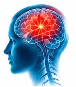 Stroke & Stroke Follow-Up